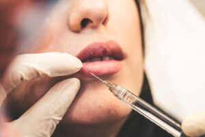 Injection into lips