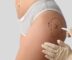 Person marking skin before non-surgical cosmetic procedure on buttocks